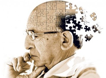 Alzheimer’ın 10 belirtisi ve tedavi yöntemleri
