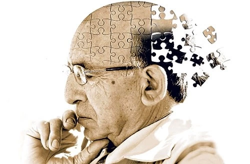 Alzheimer’ın 10 belirtisi ve tedavi yöntemleri